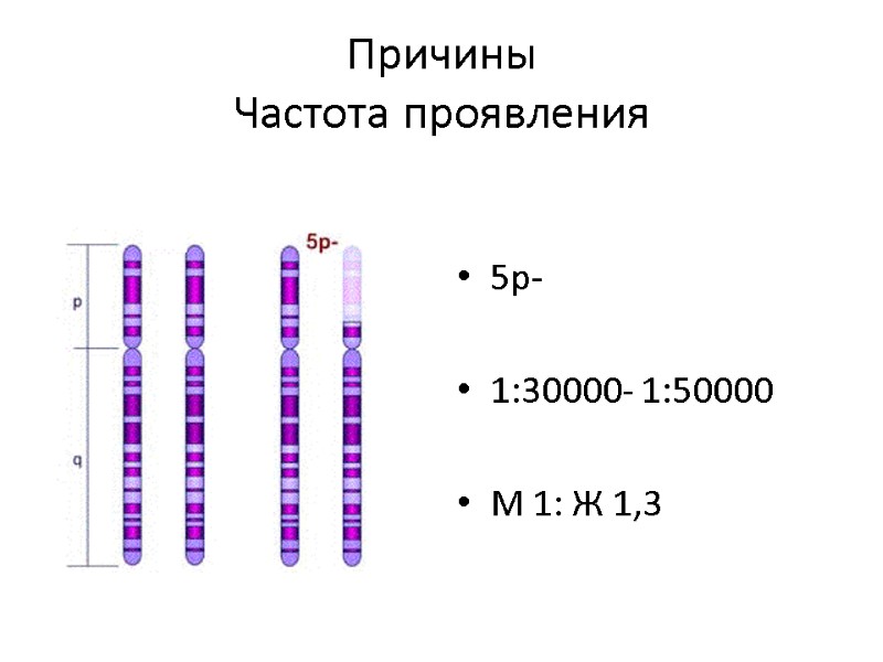 Причины Частота проявления 5p-  1:30000- 1:50000  М 1: Ж 1,3
